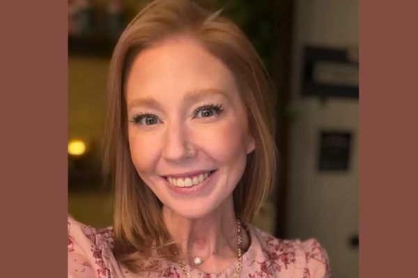 Read more about the article Cancer Took My Tongue, Not My Voice